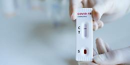 Covid: test rapidi a prezzi agevolati, in Piemonte hanno aderito già 200 farmacie