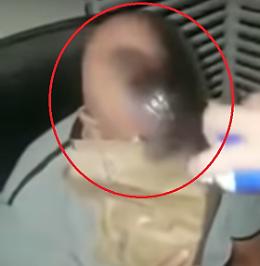 Un rimedio originale contro la caduta dei capelli