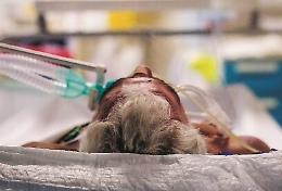 Monoclonali al palo: appena 357 pazienti curati dagli anticorpi