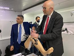 Torino, l'ospedale Koelliker punta sull'innovazione: ecco il robot Mako [FOTO E VIDEO]