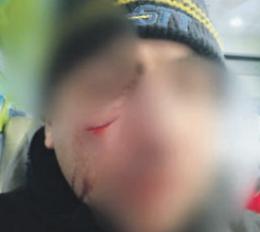 Autista del bus Gtt va in bagno e un giovane lo prende a pugni