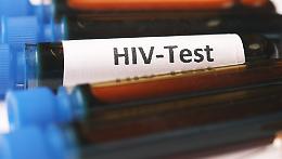 Una diagnosi di Hiv e Aids ogni 24 ore. Oltre 4.600 malati in Piemonte