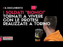 Ecco i soldati "bionici" dell'Ucraina con le protesi realizzate a Torino
