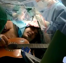 E’ morto Alan Brunetta, il musicista che suonò mentre le operavano al cervello