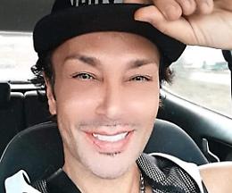 «Ho rifatto il sorriso a Zagabria e gli occhi a Istanbul: vi racconto perchè l'ho fatto e quanto ho speso»