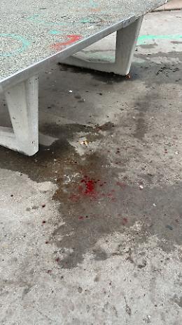 Rissa tra i barboni del portico: sangue al giardino, ferita una donna