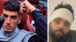 Sprangate prima del machete: «Pietro mi ha pestato a sangue sotto casa»