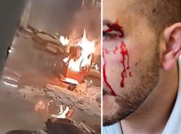 VIDEO - Emergenza carceri, un agente rischia di perdere un occhio. E la rivolta di Torino spopola su TikTok