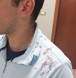 Carceri, ferito un altro agente a Torino. "Ora basta, servono i reparti speciali"