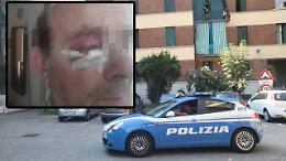 Gli rubano la pensione e lo stendono con un pugno in faccia: «Non voglio più uscire di casa»