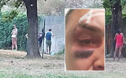 Pestato a sangue da tre tossici mentre porta fuori il cagnolino