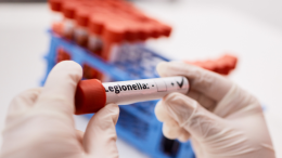 Moncalieri: allarme legionella in un condominio 