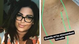 Liliam, ex vittima di tratta, picchiata dal compagno violento: «Voleva strangolarmi»