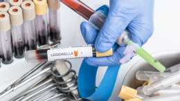 Ha un malore e finisce in ospedale: così si scopre la legionella in un condominio di Moncalieri