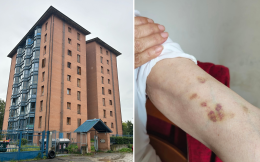 Terrore alle case popolari: picchiata e minacciata dai suoi vicini abusivi