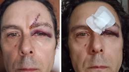 «Ragazzi, uscite da qui», e un minorenne gli sferra un pugno in faccia e lo manda all'ospedale