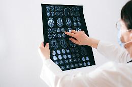 Scoperta rivoluzionaria a Torino: nuovo meccanismo per combattere le metastasi cerebrali 