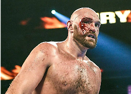 "Mi ritiro dalla boxe": il video shock di Tyson Fury che annuncia il suo addio al ring