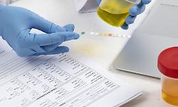 Test antidroga obbligatori per magistrati e medici: la nuova proposta di legge dell'Onorevole Romano