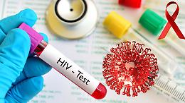 Hiv: fino a 2,9 milioni di morti entro il 2030 per i tagli agli aiuti internazionali