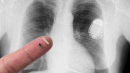 Il pacemaker più piccolo del mondo pensato per i cuori dei neonati