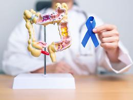 Tumore al colon in aumento tra i giovani: +500% tra gli adolescenti. Ecco i segnali da non ignorare