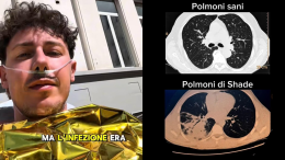 Shade ancora in ospedale: "Non è una passeggiata, ma poteva andare peggio"