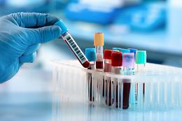 Un solo esame del sangue per scovare 12 tumori prima dei sintomi: la rivoluzione di miONCO-Dx
