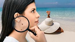 Melanoma in aumento: perché colpisce uomini e donne in modo diverso