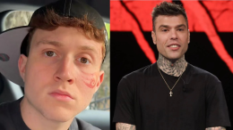 Fedez rompe il naso a Il Rosso: lo streamer amatissimo dai giovani finisce in ospedale!