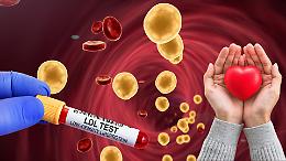 Colesterolo cattivo LDL: al via un farmaco sperimentale che lo riduce del 50%