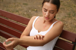Scabbia in Italia: un incremento dei casi e le difficoltà nel trattamento