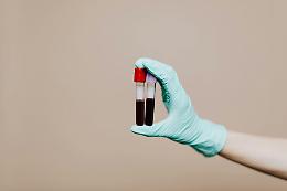 Quattro molecole nel sangue aiutano a identificare l’ADHD nascosto dietro le dipendenze: lo studio arriva dalla Spagna