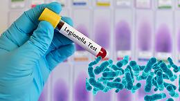 Legionella: cos'è, come si prende e perché in estate i casi aumentano