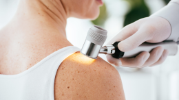 Asl di Asti: dopo un mese di chiusura, il 10 luglio riaprirà il reparto di dermatologia