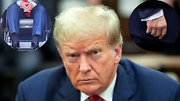 Trump allarme salute: gonfiore e lividi per il presidente americano, ma la Casa Bianca rassicura