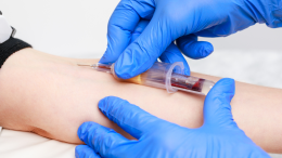 Servizi sanitari estivi: chiusure e nuovi orari nei punti prelievo dell'Asl To5