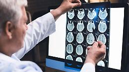 Alzheimer: fino a 4 anni per la diagnosi: : “Metà dei casi non viene riconosciuta”