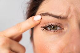 Palpebra che trema senza motivo? Potrebbe essere miochimia: ecco cosa significa davvero