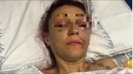 Lucia Regna, il volto spaccato a pugni «Nessuna condanna per maltrattamenti»
