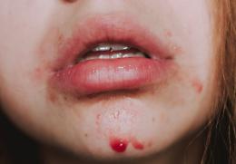 Violenza in famiglia, condannato per maltrattamenti il fratello violento: "Minacce e botte per anni"