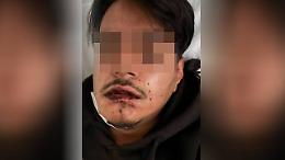 Ivan, 20 anni, esce con gli amici e viene pestato dalla baby-gang in piazza Castello 