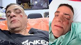 Lo youtuber anti-borseggiatore Cicalone aggredito da un gruppo di dieci: "Mi hanno colpito alle spalle"