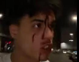 Don Alì picchiato a Milano: c’è chi dice sia solo una trovata spot