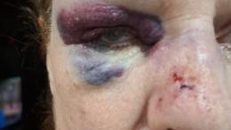 Torino, scippo violento in zona Crocetta: il ladro scappa su un monopattino 