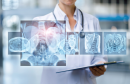 Ospedale di Ciri&egrave;, 800 mila euro per il nuovo angiografo: sala di emodinamica in cantiere