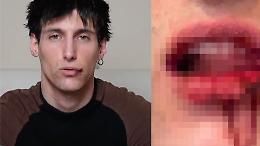 Il creator e modello Leo Mel aggredito sotto casa: un anno di minacce e violenze, &ldquo;Ma lui &egrave; ancora libero&rdquo;