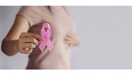 Tumore al seno: +1 milione di casi nel mondo entro il 2050 e fattori di rischio principali