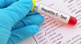 L'Epatite A arriva anche a Latina, 24 casi accertati: scattano controlli e task force