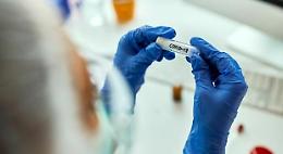 Cicada, la nuova variante Covid che sfugge alle difese: &egrave; gi&agrave; in tutto il mondo